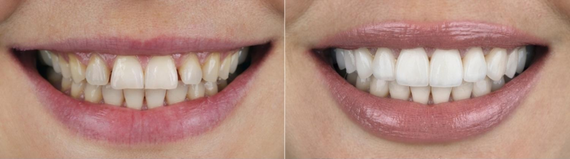 Cosmetic dentistry consultation