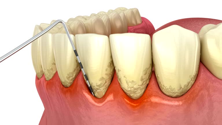 Gum health evaluation