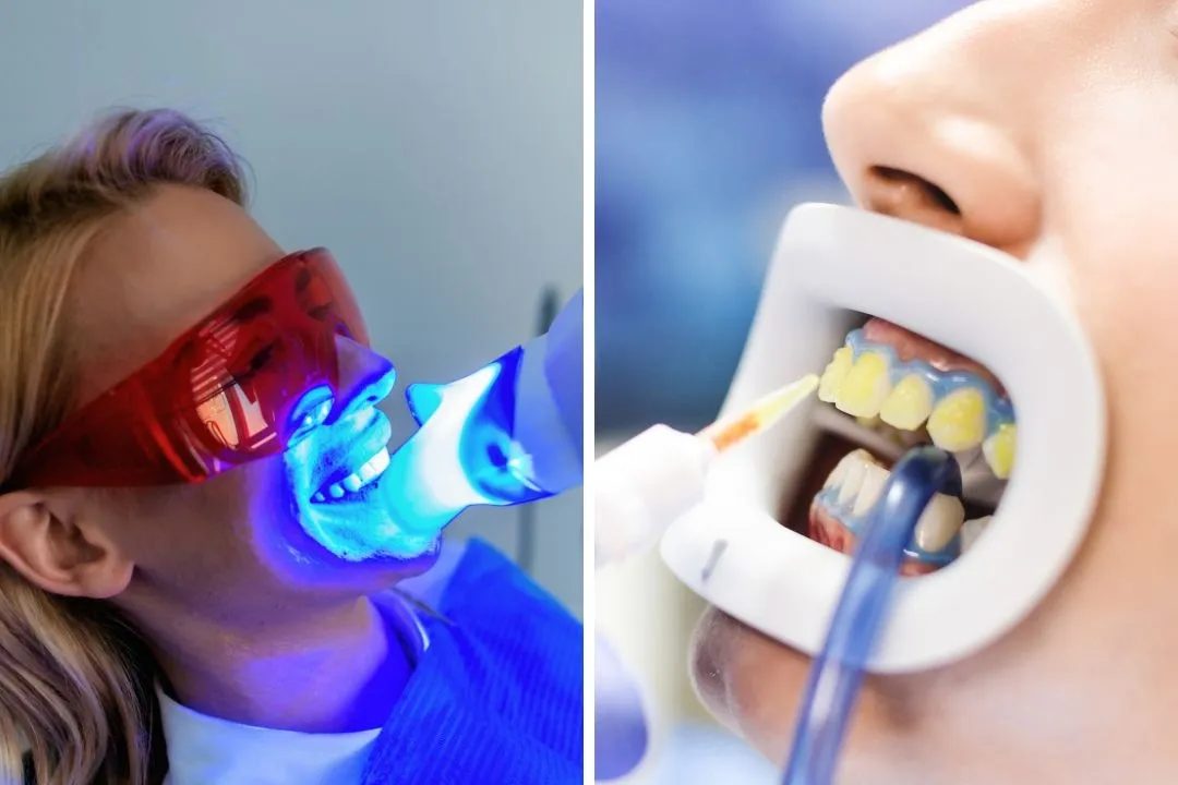 The whitening process